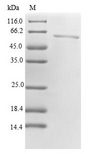 PPP2R4 Protein - (Tris-Glycine gel) Discontinuous SDS-PAGE (reduced) with 5% enrichment gel and 15% separation gel.