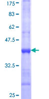 PPP2R4 Protein - 12.5% SDS-PAGE Stained with Coomassie Blue.