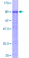 PPP2R5A Protein - 12.5% SDS-PAGE of human PPP2R5A stained with Coomassie Blue