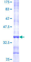 PPP2R5A Protein - 12.5% SDS-PAGE Stained with Coomassie Blue.