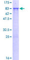 PPP2R5C Protein - 12.5% SDS-PAGE of human PPP2R5C stained with Coomassie Blue