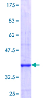 PPP2R5C Protein - 12.5% SDS-PAGE Stained with Coomassie Blue.