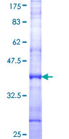 PPP2R5E Protein - 12.5% SDS-PAGE Stained with Coomassie Blue