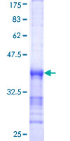 PPP3CA / CCN1 / Calcineurin A Protein - 12.5% SDS-PAGE Stained with Coomassie Blue