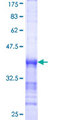 PPP3CA / CCN1 / Calcineurin A Protein - 12.5% SDS-PAGE Stained with Coomassie Blue