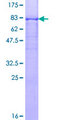 PPP3CB Protein - 12.5% SDS-PAGE of human PPP3CB stained with Coomassie Blue