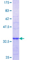 PPP3CC / CALNA3 Protein - 12.5% SDS-PAGE Stained with Coomassie Blue.