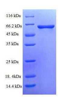PPP3CC / CALNA3 Protein