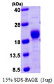 PPP3R1 / Calcineurin B Protein