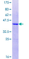 PPP3R2 Protein - 12.5% SDS-PAGE of human PPP3R2 stained with Coomassie Blue
