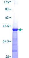 PPP3R2 Protein - 12.5% SDS-PAGE Stained with Coomassie Blue.