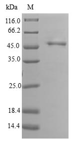 PPP3R2 Protein - (Tris-Glycine gel) Discontinuous SDS-PAGE (reduced) with 5% enrichment gel and 15% separation gel.