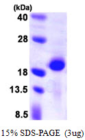 PPP3R2 Protein