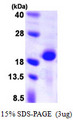 PPP3R2 Protein