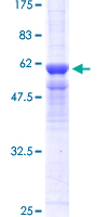 PPP4C Protein - 12.5% SDS-PAGE of human PPP4C stained with Coomassie Blue