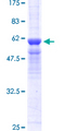 PPP4C Protein - 12.5% SDS-PAGE of human PPP4C stained with Coomassie Blue