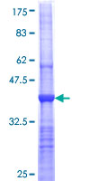 PPP4C Protein - 12.5% SDS-PAGE Stained with Coomassie Blue.