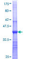 PPP4C Protein - 12.5% SDS-PAGE Stained with Coomassie Blue.