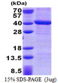PPP4C Protein