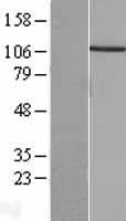 PPP4R1 / PP4R1 Protein - Western validation with an anti-DDK antibody * L: Control HEK293 lysate R: Over-expression lysate