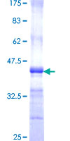 PPP4R1 / PP4R1 Protein - 12.5% SDS-PAGE Stained with Coomassie Blue.