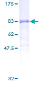 PPP5C Protein - 12.5% SDS-PAGE of human PPP5C stained with Coomassie Blue