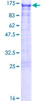 PPP6R2 / SAPS2 Protein - 12.5% SDS-PAGE of human SAPS2 stained with Coomassie Blue