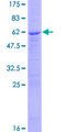 PPT1 / CLN1 Protein - 12.5% SDS-PAGE of human PPT1 stained with Coomassie Blue
