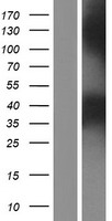 PPT2 Protein - Western validation with an anti-DDK antibody * L: Control HEK293 lysate R: Over-expression lysate