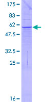 PPT2 Protein - 12.5% SDS-PAGE of human PPT2 stained with Coomassie Blue