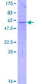PPT2 Protein - 12.5% SDS-PAGE of human PPT2 stained with Coomassie Blue