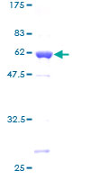 PQBP1 Protein - 12.5% SDS-PAGE of human PQBP1 stained with Coomassie Blue