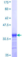 PQBP1 Protein - 12.5% SDS-PAGE Stained with Coomassie Blue.
