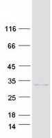 PQLC1 Protein - Purified recombinant protein PQLC1 was analyzed by SDS-PAGE gel and Coomassie Blue Staining