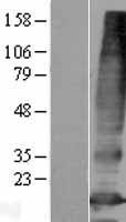 PQLC3 Protein - Western validation with an anti-DDK antibody * L: Control HEK293 lysate R: Over-expression lysate