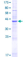 PQLC3 Protein - 12.5% SDS-PAGE of human PQLC3 stained with Coomassie Blue