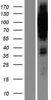 PR / Progesterone Receptor Protein - Western validation with an anti-DDK antibody * L: Control HEK293 lysate R: Over-expression lysate