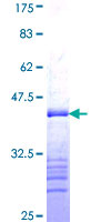 PR / Progesterone Receptor Protein - 12.5% SDS-PAGE Stained with Coomassie Blue.