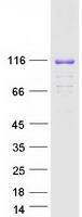 PR / Progesterone Receptor Protein - Purified recombinant protein PGR was analyzed by SDS-PAGE gel and Coomassie Blue Staining