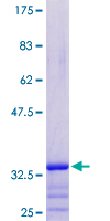 PRAC1 / PRAC Protein - 12.5% SDS-PAGE of human PRAC stained with Coomassie Blue