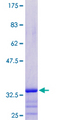 PRAC1 / PRAC Protein - 12.5% SDS-PAGE of human PRAC stained with Coomassie Blue