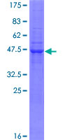 PRADC1 Protein - 12.5% SDS-PAGE of human C2orf7 stained with Coomassie Blue