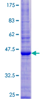 PRAF2 Protein - 12.5% SDS-PAGE of human PRAF2 stained with Coomassie Blue