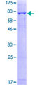 PRAME Protein - 12.5% SDS-PAGE of human PRAME stained with Coomassie Blue