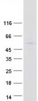 PRAMEF19 Protein - Purified recombinant protein PRAMEF19 was analyzed by SDS-PAGE gel and Coomassie Blue Staining