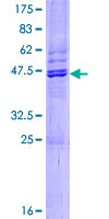 PRAP1 Protein - 12.5% SDS-PAGE of human PRAP1 stained with Coomassie Blue