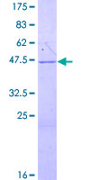 PRB3 Protein - 12.5% SDS-PAGE of human PRB3 stained with Coomassie Blue