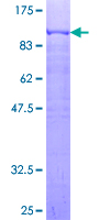 PRC1 Protein - 12.5% SDS-PAGE of human PRC1 stained with Coomassie Blue