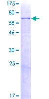 PRCP Protein - 12.5% SDS-PAGE of human PRCP stained with Coomassie Blue