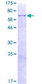 PRCP Protein - 12.5% SDS-PAGE of human PRCP stained with Coomassie Blue